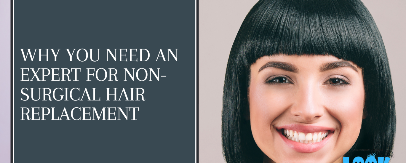 Why You Need an Expert for Non-Surgical Hair Replacement