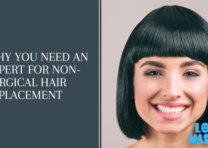 Why You Need an Expert for Non-Surgical Hair Replacement