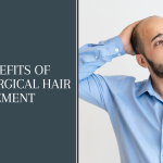 Key Benefits of Non-Surgical Hair Replacement