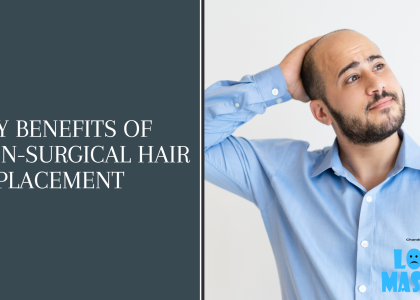 Key Benefits of Non-Surgical Hair Replacement