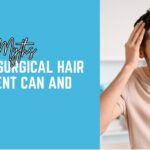 Debunking Myths: What Non-Surgical Hair Replacement Can and Can't Do