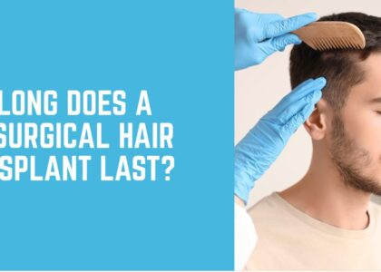 How Long Does a Non-Surgical Hair Transplant Last?