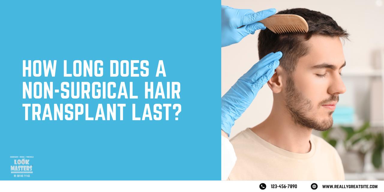 How Long Does a Non-Surgical Hair Transplant Last?