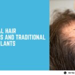 hair transplant compairision