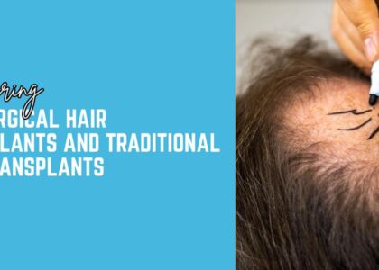 Comparing Non-Surgical Hair Transplants and Traditional Hair Transplants