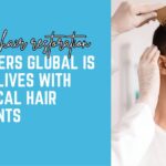 The Future of Hair Restoration: How Lookmasters Global is Changing Lives with Non-Surgical Hair Transplants