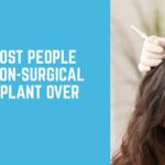 Why More People Are Choosing Non-Surgical Hair Transplants Over Surgery
