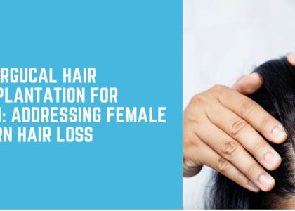 Non-Surgical Hair Transplantation for Women: Addressing Female Pattern Hair Loss