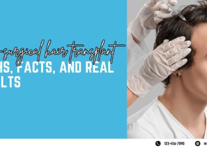 non-surgical hair transplant