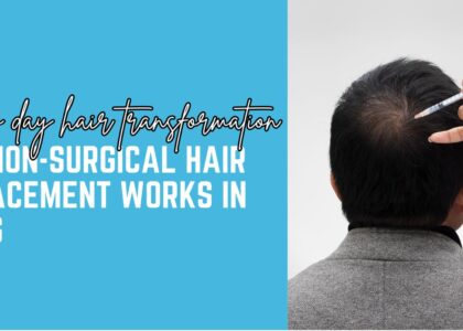 Everything You Should Know Before Getting a Hair Patch Treatment