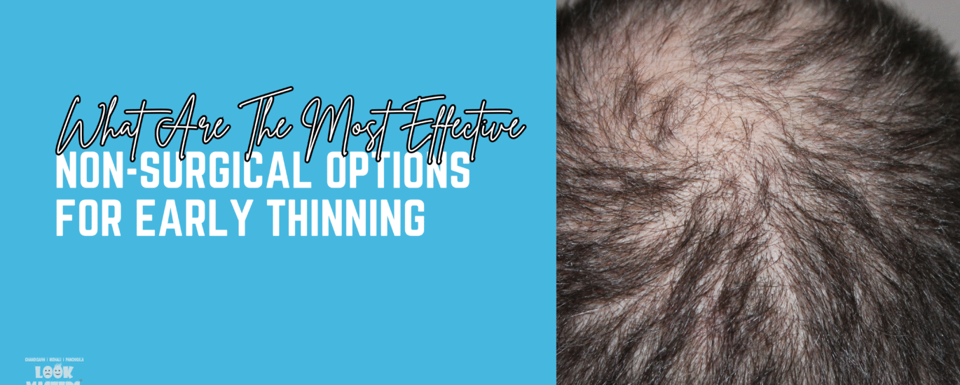 What Are The Most Effective Non-Surgical Options For Early Thinning