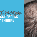 What Are The Most Effective Non-Surgical Options For Early Thinning
