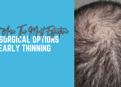 What Are The Most Effective Non-Surgical Options For Early Thinning