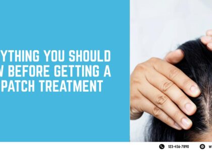 Everything You Should Know Before Getting a Hair Patch Treatment