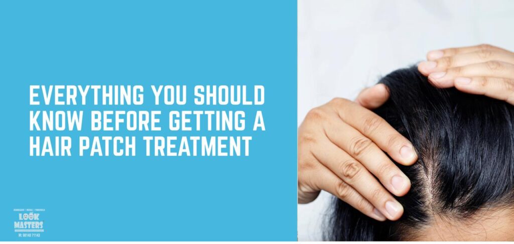 Everything You Should Know Before Getting a Hair Patch Treatment