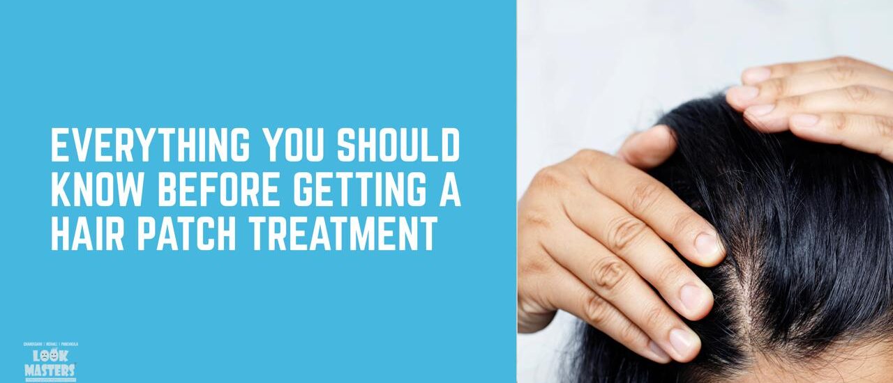 Everything You Should Know Before Getting a Hair Patch Treatment