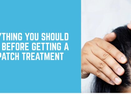 Everything You Should Know Before Getting a Hair Patch Treatment