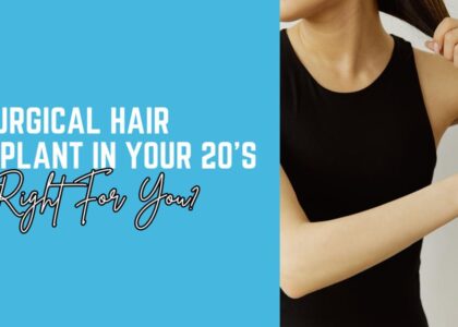 Non-Surgical Hair Transplantation in Your 20s: Is It Right for You?