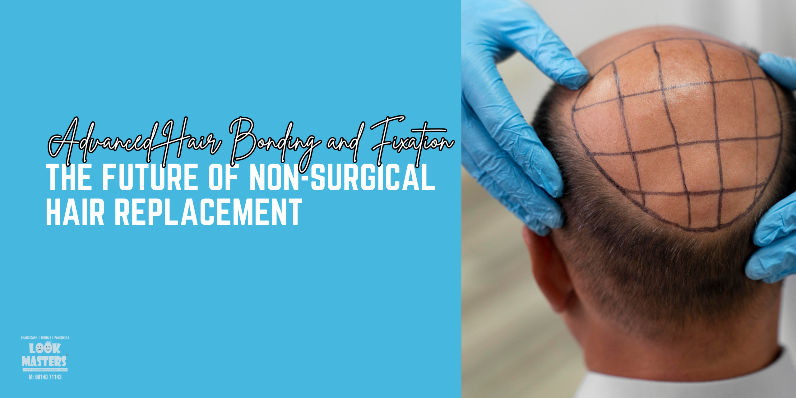 Advanced Hair Bonding and Fixation: The Future of Non-Surgical Hair Replacement