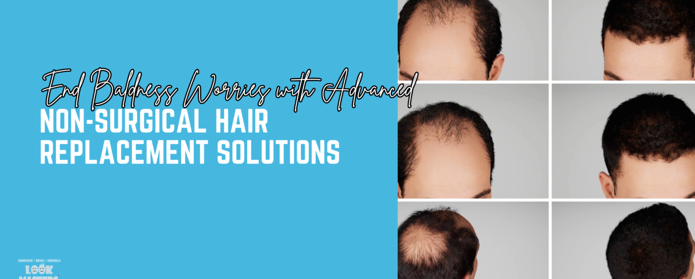 Say Goodbye to Baldness with Advanced Non-Surgical Hair Replacement