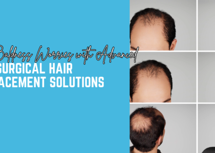 Say Goodbye to Baldness with Advanced Non-Surgical Hair Replacement