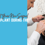 How to Protect Your Non-Surgical Hair Transplant During the Monsoon
