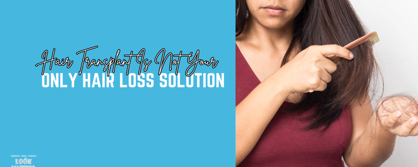 Hair Transplant Is Not Your Only Hair Loss Solution