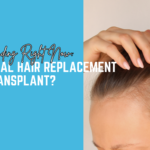 Non-Surgical Hair Replacement vs Hair Transplant: What Is Trending Right Now?