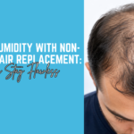 Battling Humidity with Non-Surgical Hair Replacement: How Systems Stay Flawless