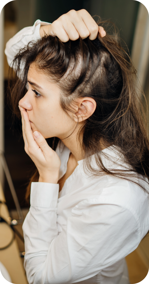 Why Choose Non-Surgical Hair Restoration?
