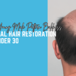 Overcoming Young Male Pattern Baldness: Non-Surgical Hair Restoration for Men Under 30