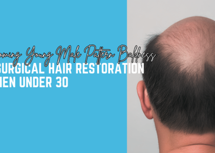 Overcoming Young Male Pattern Baldness: Non-Surgical Hair Restoration for Men Under 30