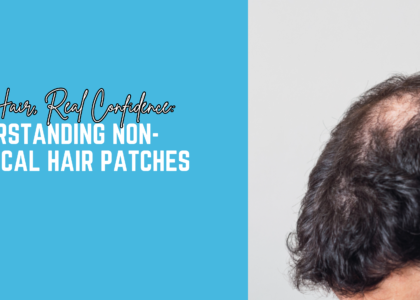 Real Hair, Real Confidence: Understanding Non-Surgical Hair Patches