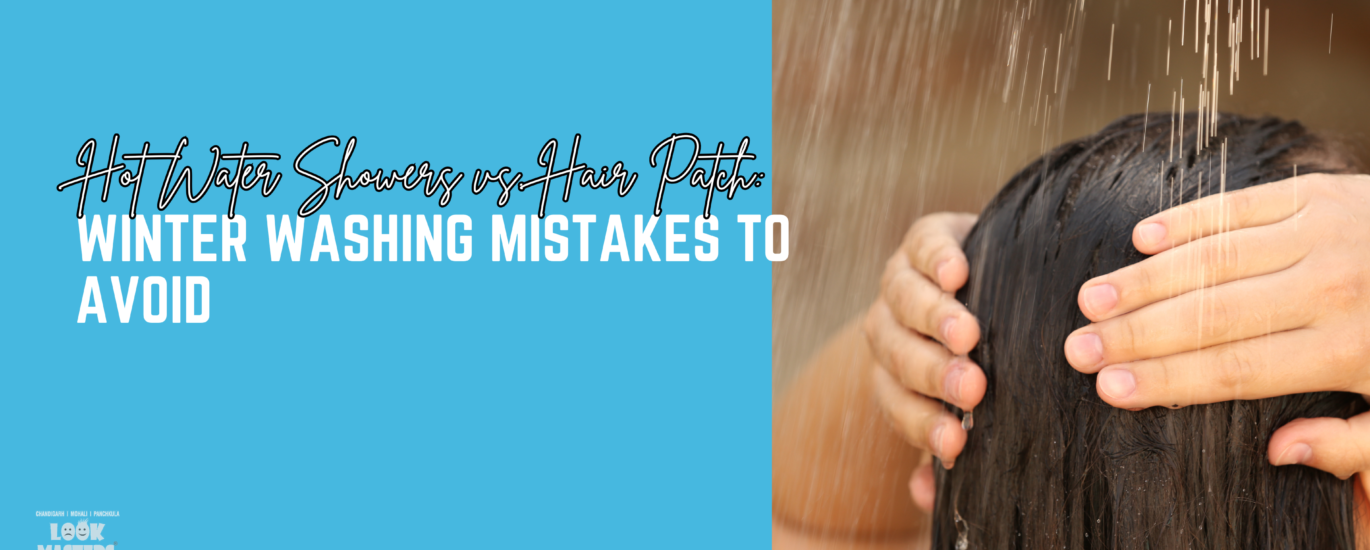 Hot Water Showers vs. Hair Patch: Winter Washing Mistakes to Avoid
